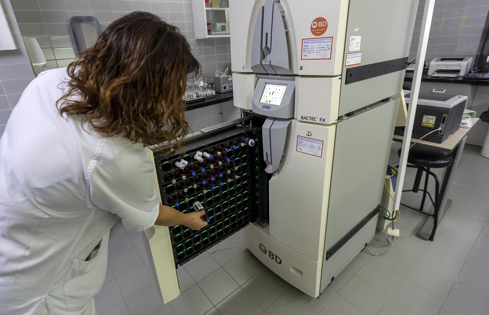 Protocolo para optimizar la respuesta rápida en código sepsis en Alicante