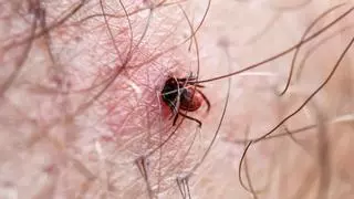 Picaduras de garrapatas: cómo prevenir la enfermedad de Lyme, que puede causar discapacidad