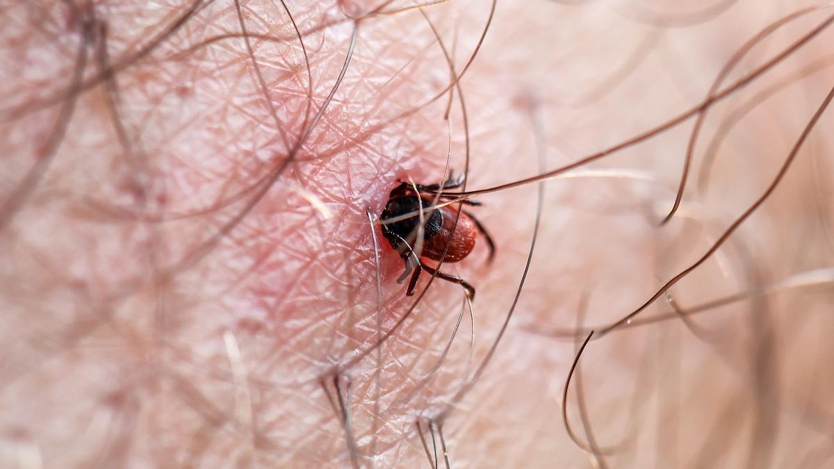 Qué es la enfermedad de Lyme y cómo prevenirla