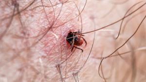 Qué es la enfermedad de Lyme y cómo prevenirla