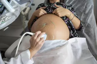 El escaso porcentaje de abortos en la sanidad pública alicantina