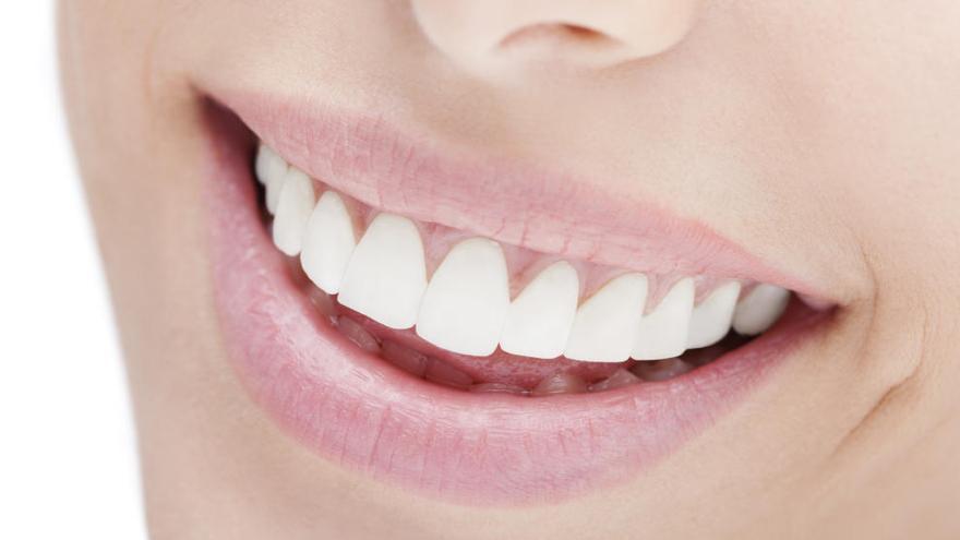La blancorexia es la obsesión por los dientes blancos.