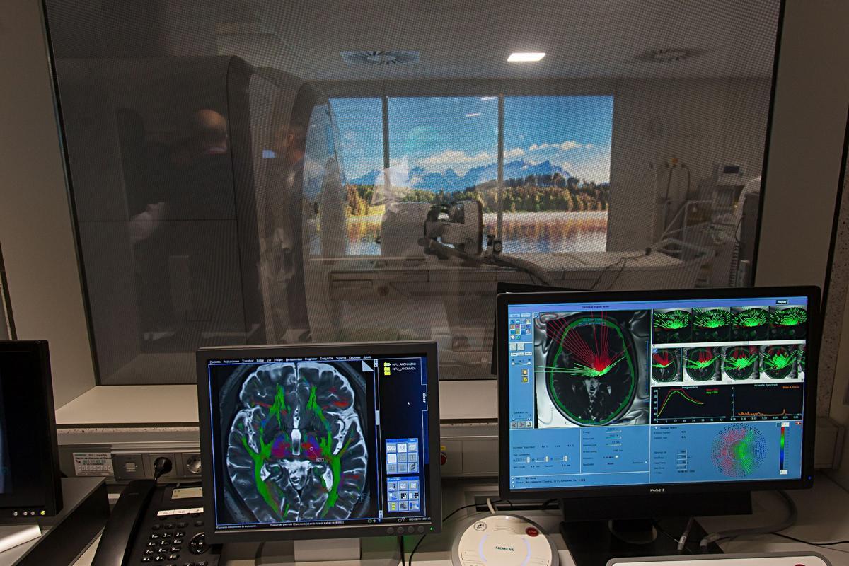 El HIFU es una técnica no invasiva para mejorar el temblor esencial