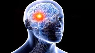 Neurorrehabilitación: La nueva palabra clave para la calidad de vida en los tumores cerebrales