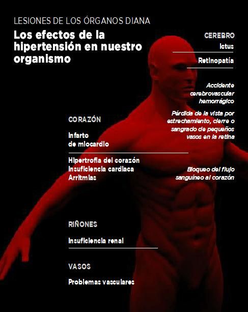 Factores de riesgo de la hipertensión arterial