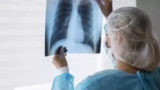 Salud detecta cuatro casos de tuberculosis en Asturias: cómo se contagia la enfermedad