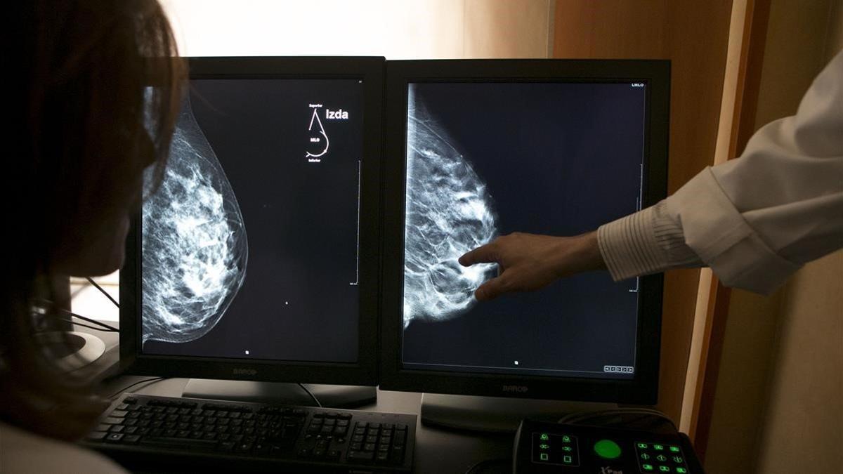 Unos médicos analizan unas mamas en una pantalla.