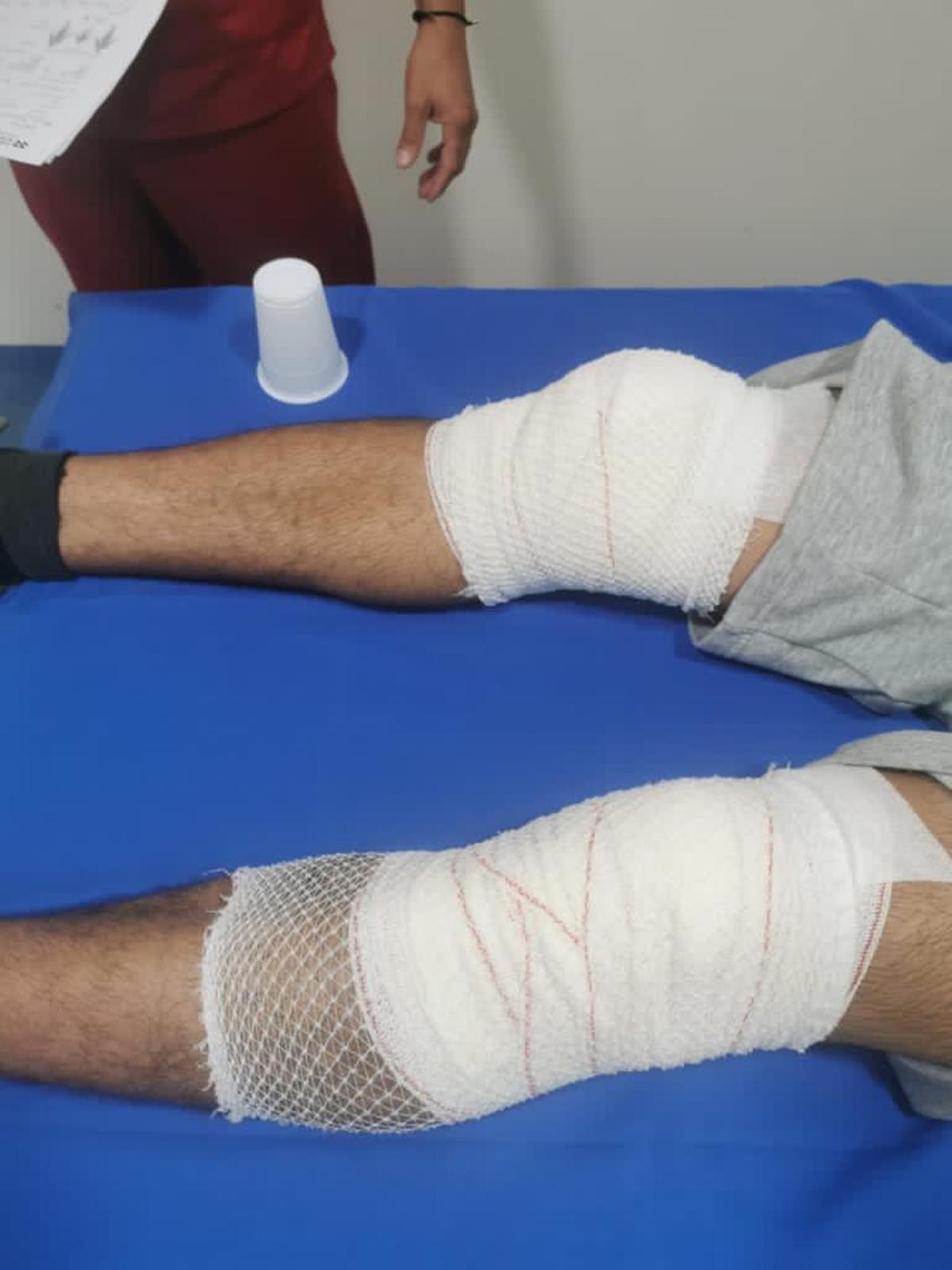Kevin muestra sus heridas tras la trifulca Kevin muestra sus heridas tras la trifulca