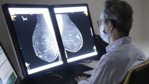 Els errors en el cribratge del càncer de mama obren una crisi a Andalusia