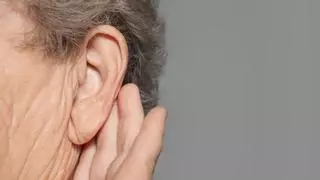Implante coclear: qué es, a quién se le puede implantar para curar la sordera y cómo se hace