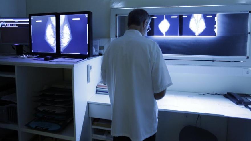 Un oncóogo revisa radiografías de mama.