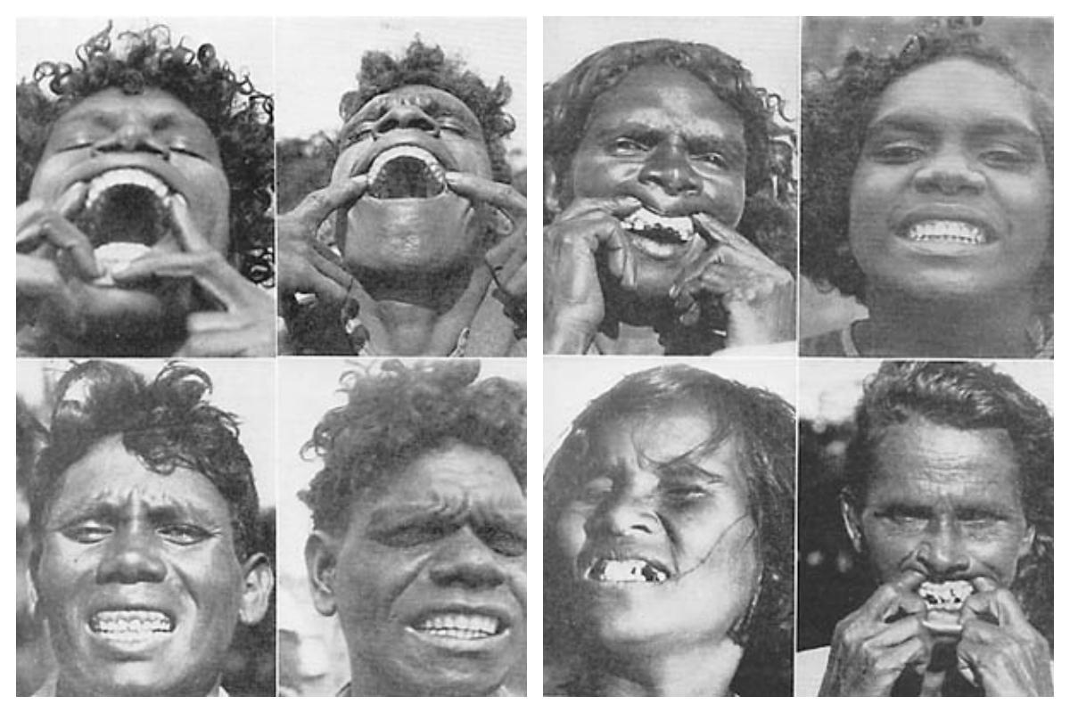 Pruebas de aborígenes australianos aislados y modernizados de Weston Price