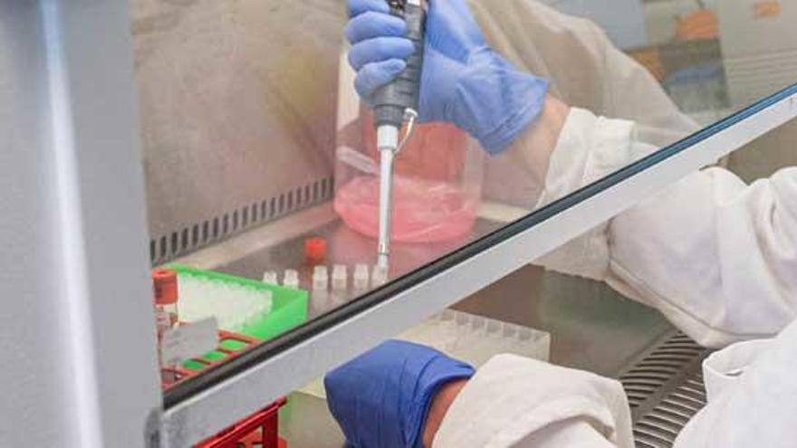 Pena Infectado El 86% de los infectados no tiene síntomas específicos, según un estudio