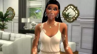 Los Sims 4 implementa la característica de piel de vitíligo en el videojuego