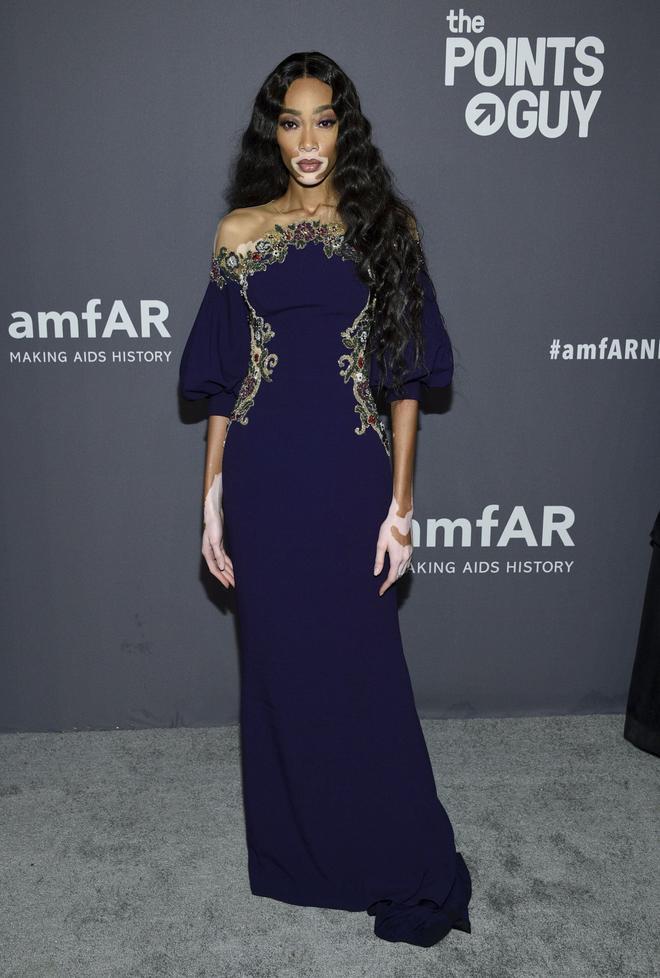 Winnie Harlow