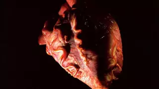 La ciencia consigue el milagro de trasplantar un corazón que había muerto