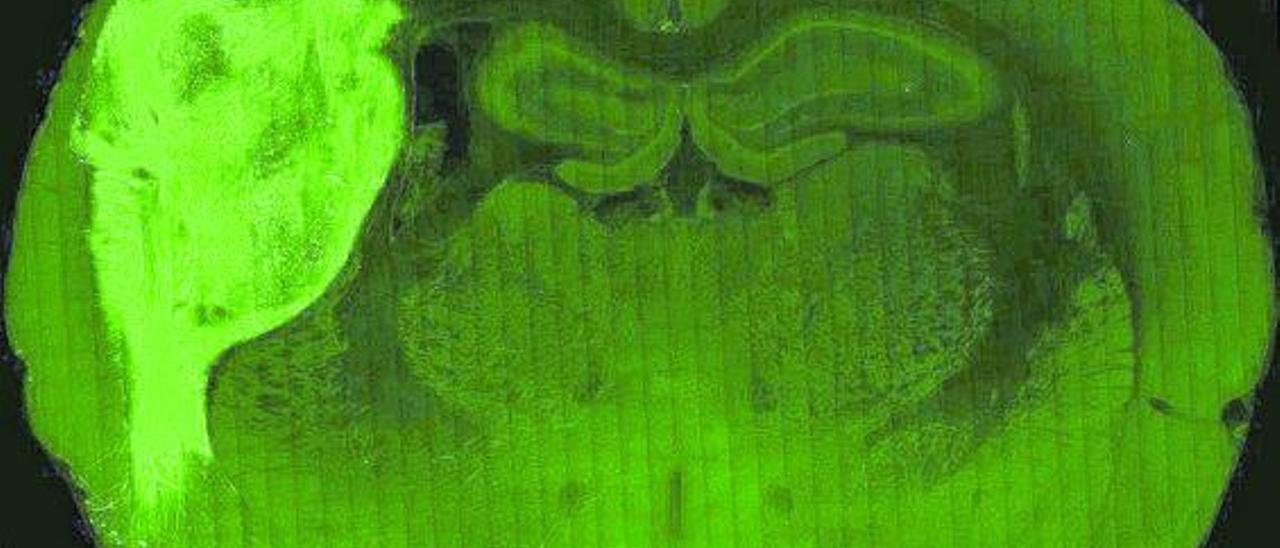 Imagen del ‘minicerebro’ de células humanas trasplantado a una rata.   | // UNIVERSIDAD DE STANFORD