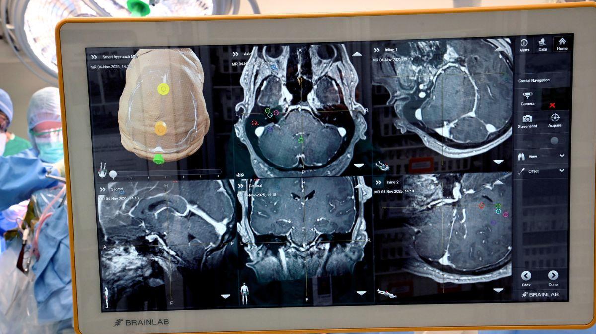 La operación abre una nueva vía para interpretar señales cerebrales en regiones vinculadas a funciones más complejas.