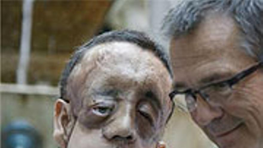 El trasplantado de cara en Sevilla comparece públicamente para dar las gracias al donante