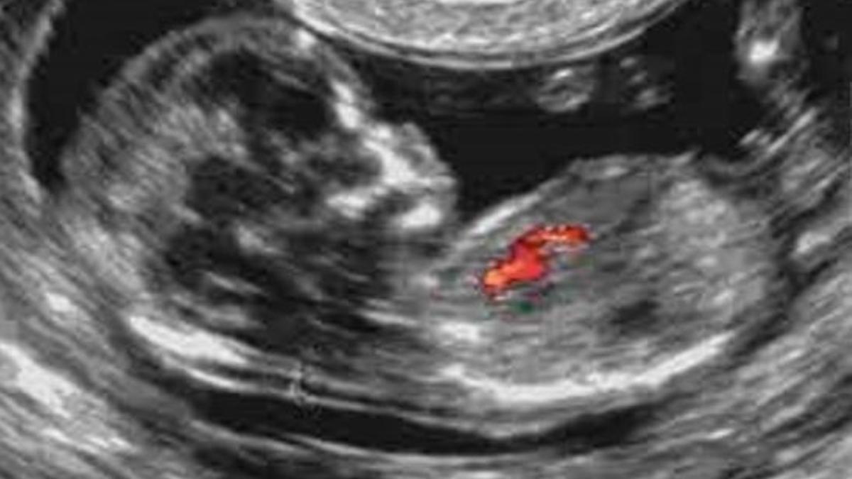 Una de les ecografies a un fetus.