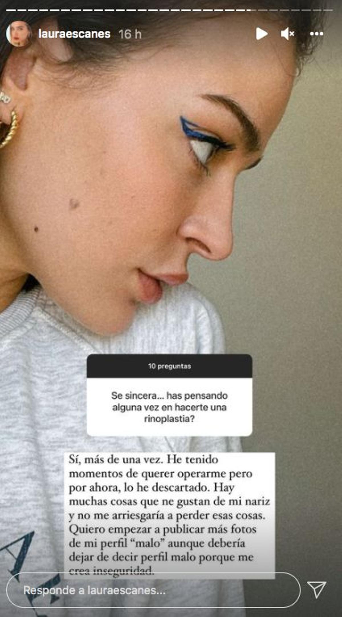 Laura Escanes habla sobre si ha pensado hacerse una rinoplastia