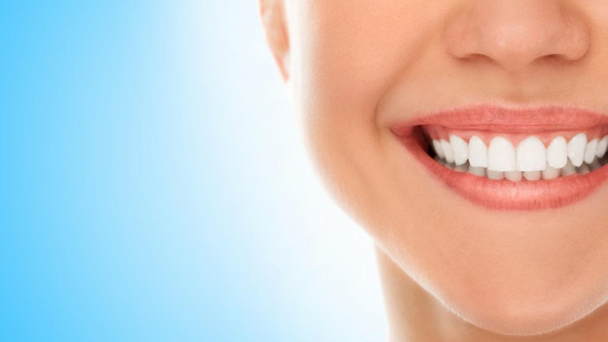 El blanqueamiento dental es una técnica que consiste en aclarar el color de los dientes.