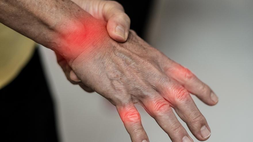 Qué es la artrosis, cómo nos puede afectar y por qué no se debe confundir con la artritis