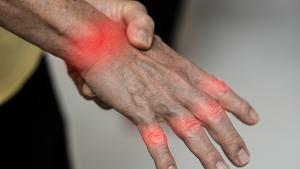 Más de 7 millones de personas en España sufre artrosis.