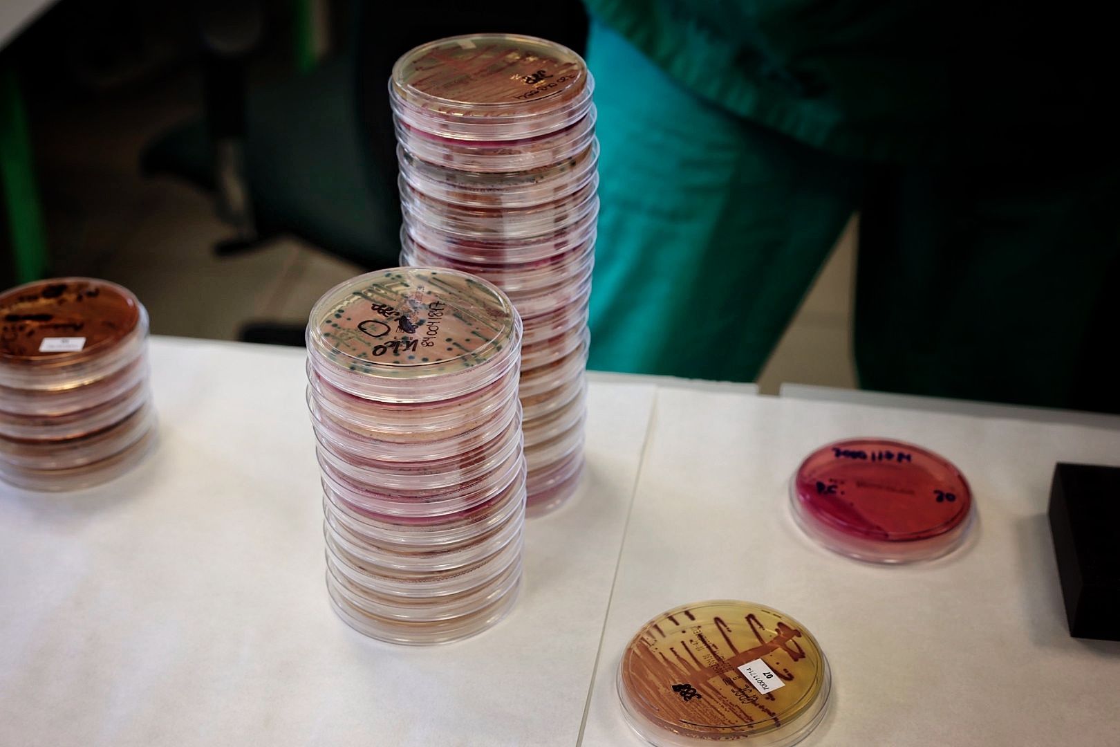 El área de microbiología del Hospital de La Candelaria es referente en detección de bacterias multirresistentes.