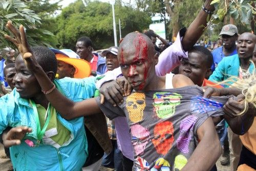 Un partidario de la Coalición de la oposición de Kenia para las Reformas y la Democracia sangra de una herida en la cabeza, en Nairobi, Kenia.