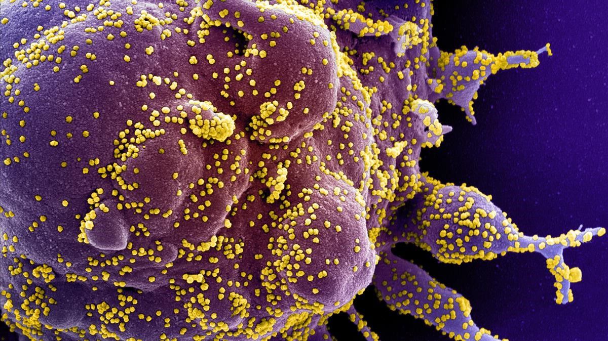 Micrografia electronica de barrido coloreada de una celula apoptotica  en morado  infectada con particulas del virus SARS-COV-2  en color amarillo  aislada de una muestra de paciente  capturada y mejorada por Centro de Investigacion Integrada del Instituto estadounidense de Alergia y Enfermedades Infecciosas (NIAID)  en Hamilton   Montana (Estados Unidos de America)  a 13 de febrero de 2020   CORONAVIRUS COVID-19 ESTADO DE ALARMA PANDEMIA LABORATORIO NIAID   NIAID  (Foto de ARCHIVO)   virus  coronavirus  covid19 covid 19 generico recurso    13 02 2020