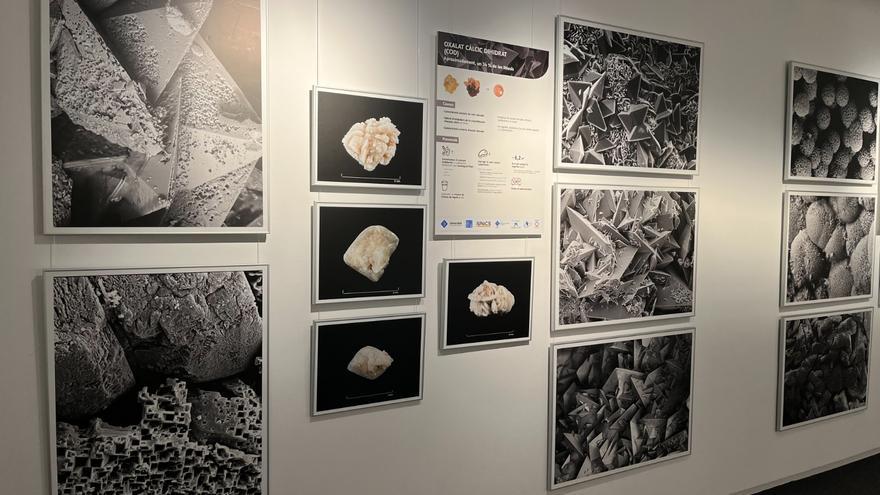 El arte microscópico de las piedras en el riñón: el CaixaForum de Palma acoge una muestra fotográfica