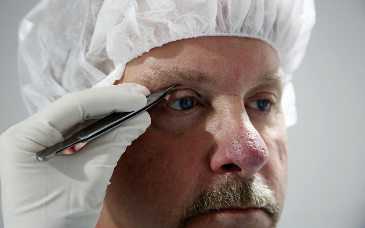 Hombre preparándose para una operación estética.