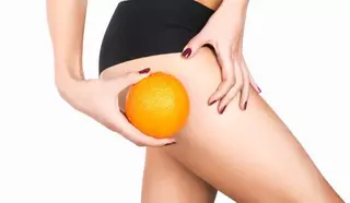 ¿Se puede eliminar la celulitis al 100%?