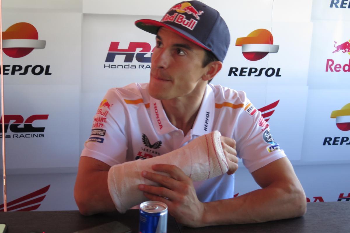 Marc Márquez (Honda) se ha fracturado un dedo pulgar de la mano derecha.