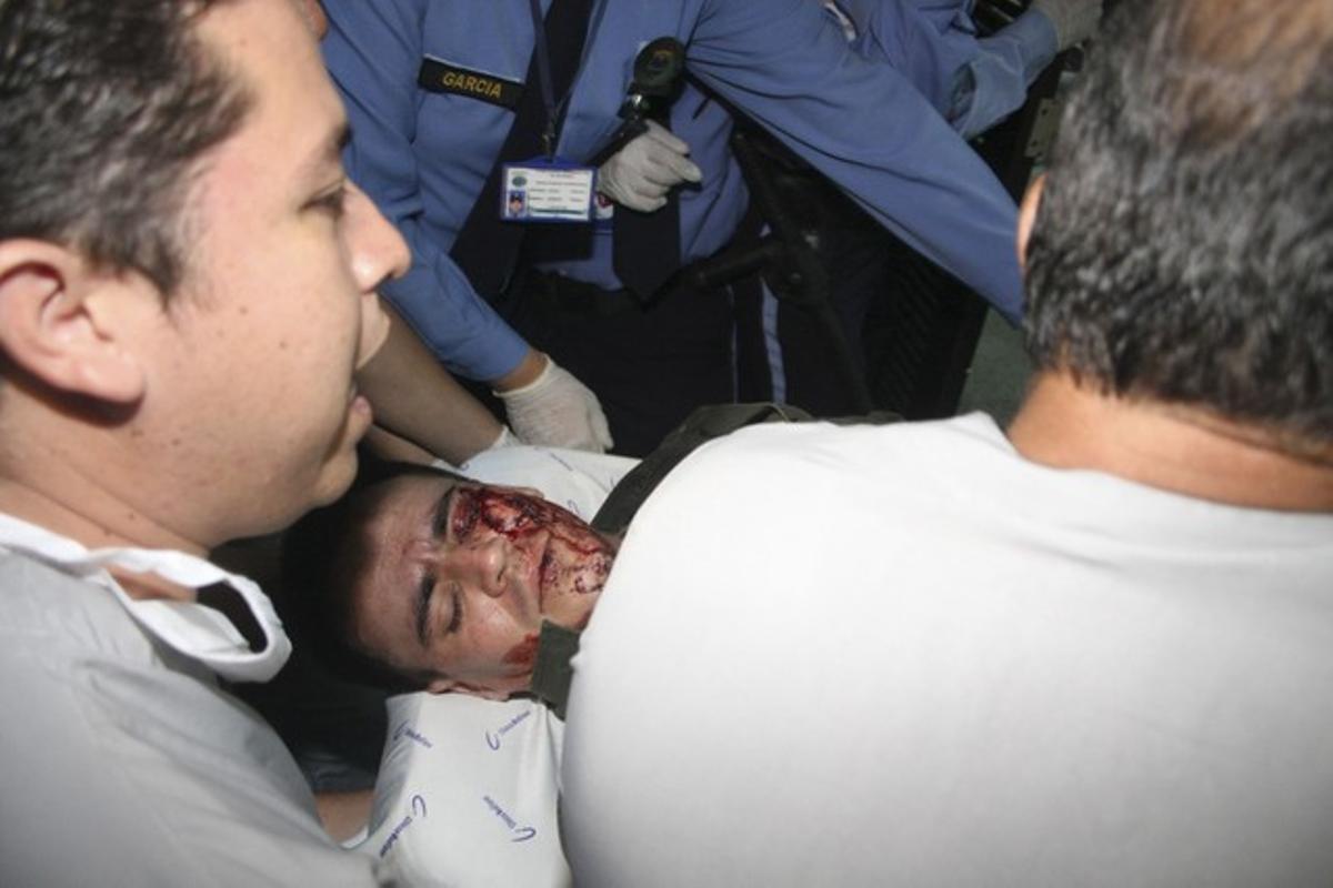 Un policia colombià és atès després de resultar ferit en l’explosió d’un cotxe bomba, dimarts, a Vegalarga, al sud de Colòmbia.