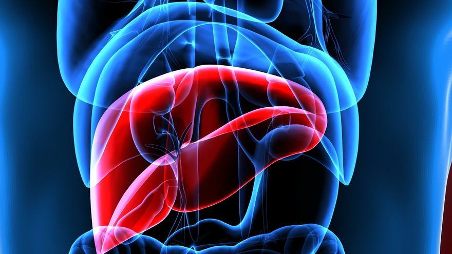 Cada vez hay más hígado graso, y triplica el riesgo de padecer la tercera causa de muerte