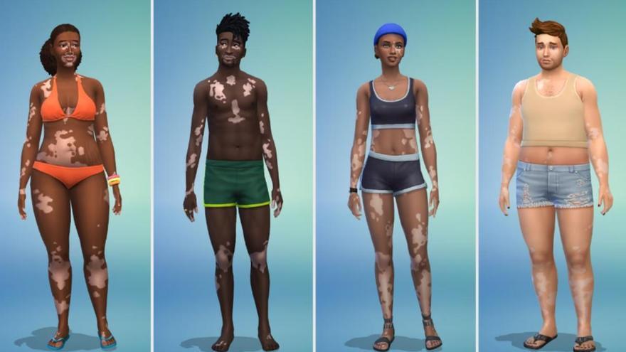 Els Sims 4 ofereixen &quot;skin&quot; vitiligen: la diversitat és la clau