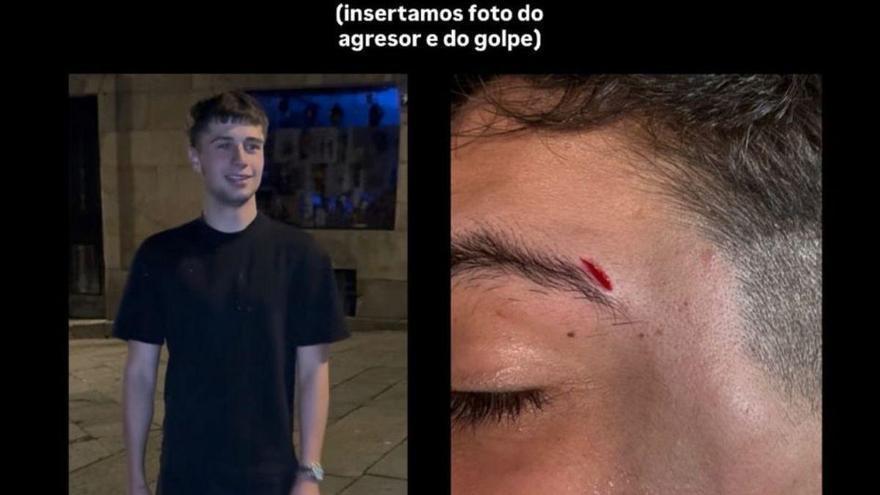 Denuncian una agresión homófoba en Santiago al grito de «bujarras de mierda»