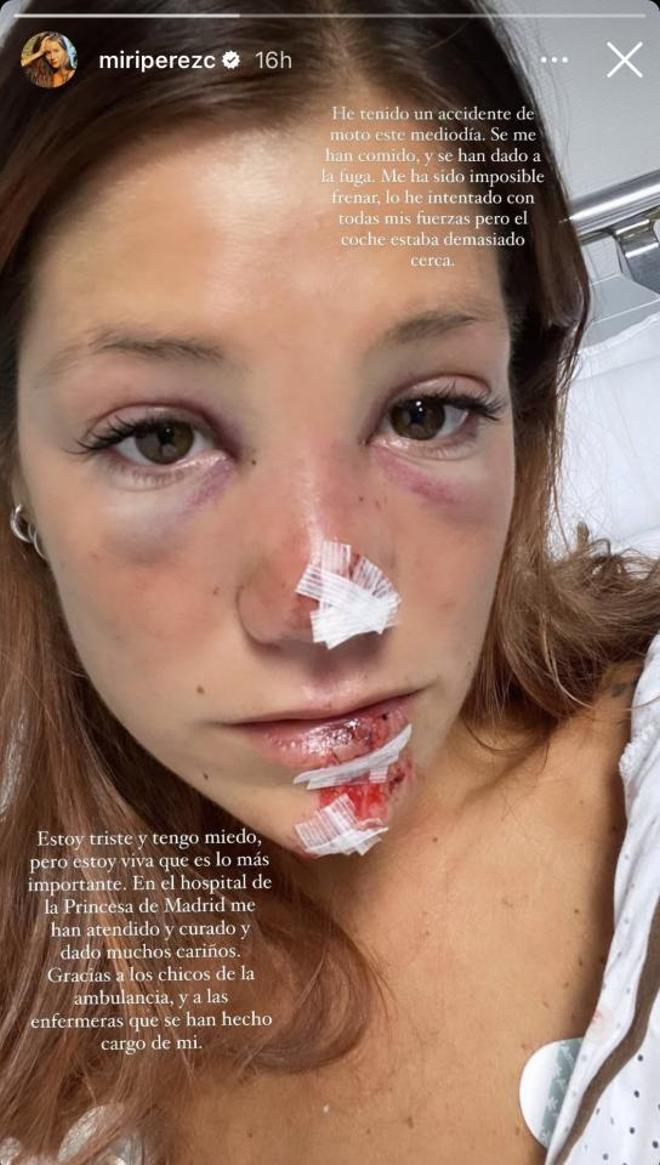 La cara de Miri ('Masterchef') tras sufrir un accidente de moto