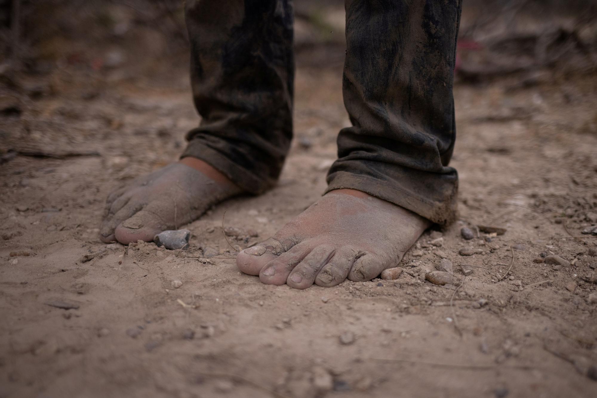 Los pies sucios de un inmigrante que busca asilo en Honduras