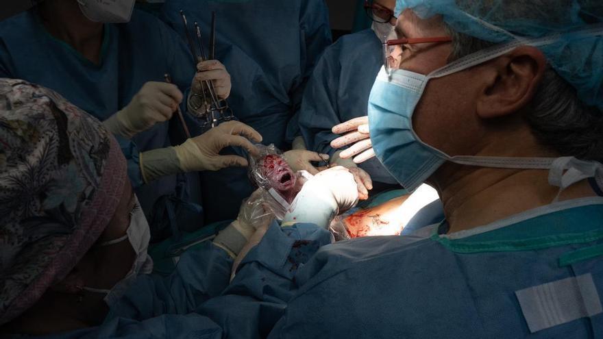 Una pareja murciana logra tener el primer hijo nacido de un útero trasplantado en España