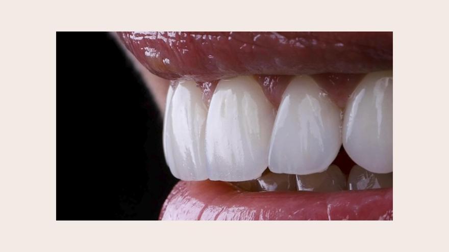 Premio Estética Dental: Clínica MVOCA