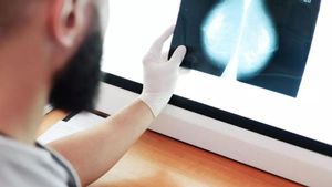 Andalusia trucarà a 2.000 dones en una setmana per detectar si hi va haver fallades en el cribratge de càncer de mama