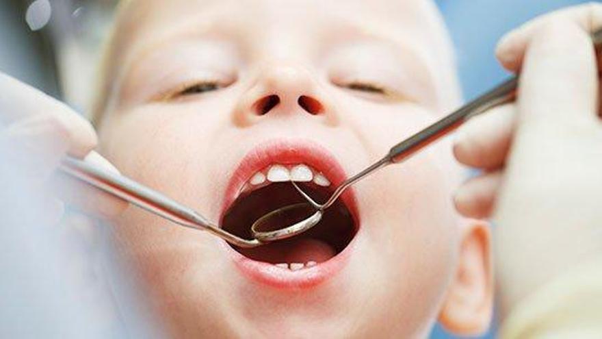 Cómo evitar la aparición de caries