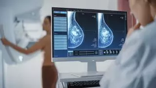 El Botànic dejó fuera de las mamografías de prevención del cáncer de mama a 167.083 mujeres mayores de 45 años