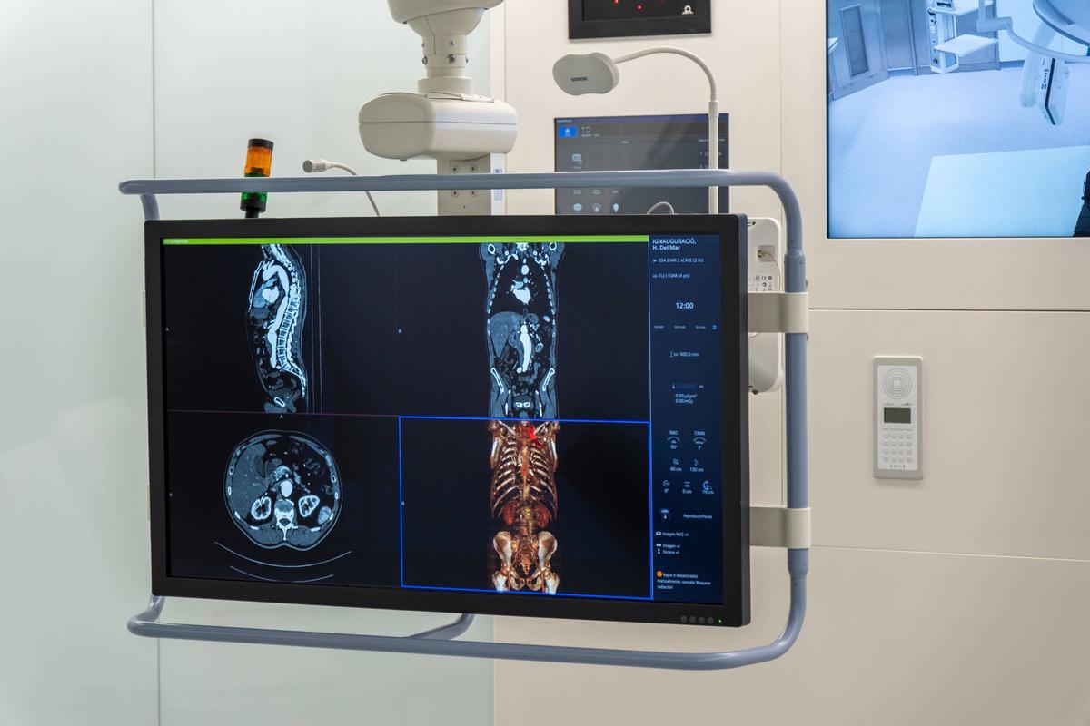 Pruebas médicas dentro del nuevo quirófano de cirugía vascular.