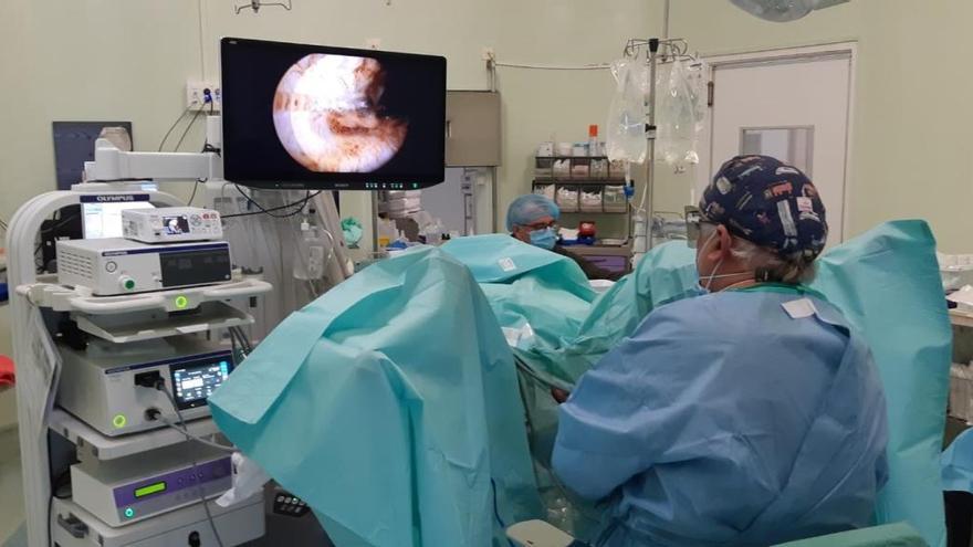 Incorporan el uso de visión 3D en la cirugía endoscópica de la próstata