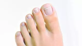 Per què canvien de color les ungles dels peus?
