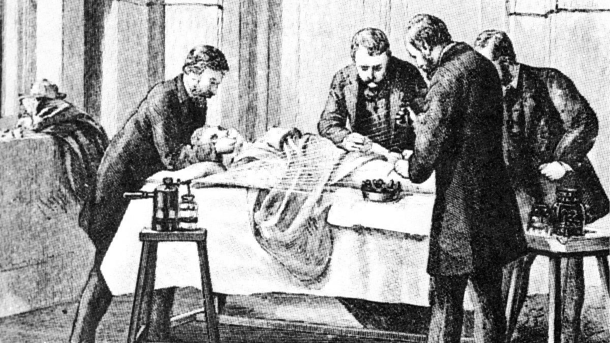 Intervención quirúrgica a mediados del siglo XIX